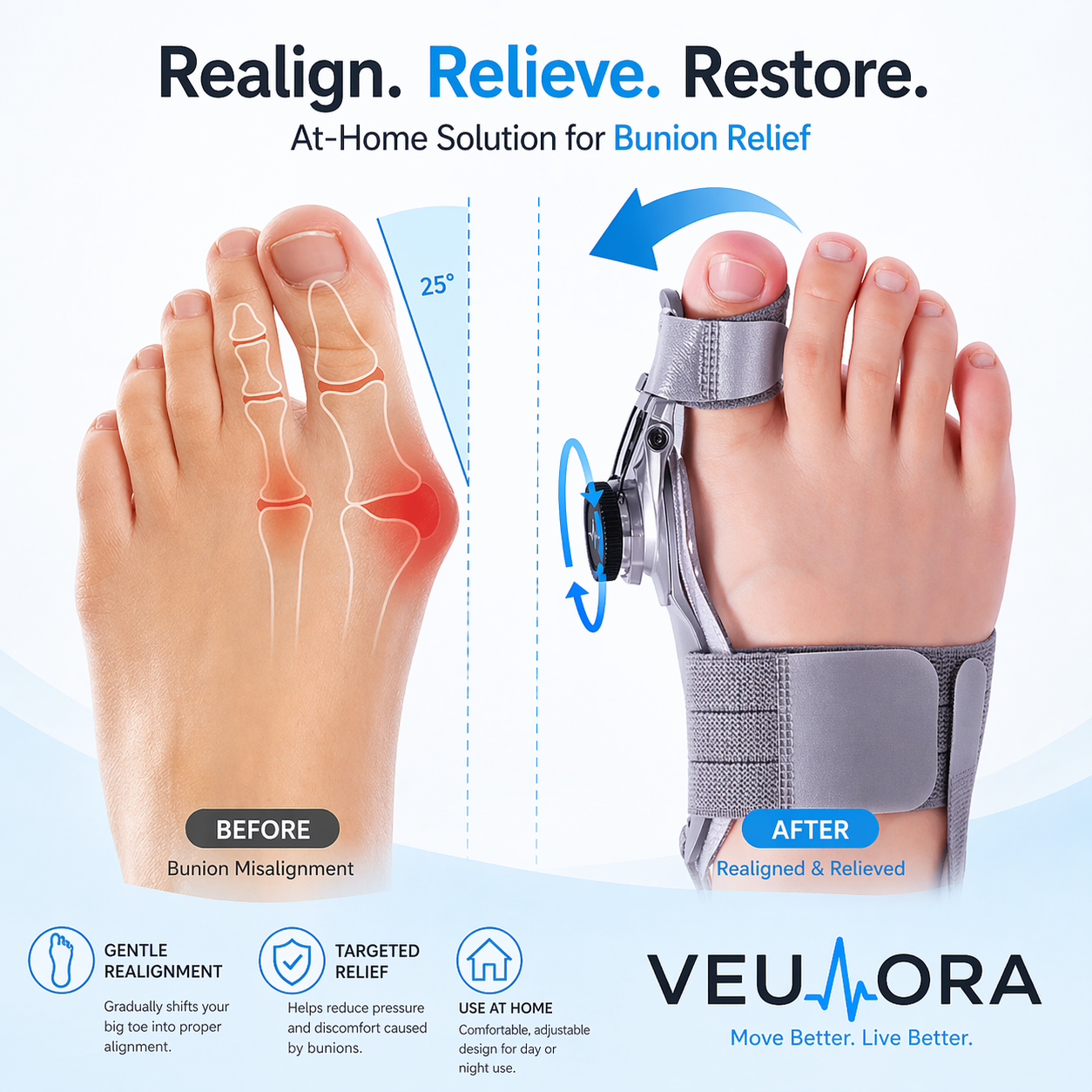Veulora ™ Bunion Fix